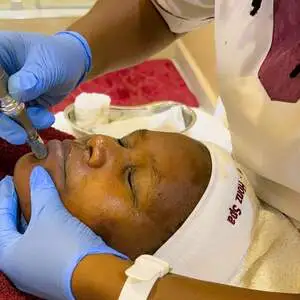 A spa therapist performing a microneedling facial treatment on a relaxed client at Viv’s In-Houz Spa studio at Kitisuru west mall, Nairobi, using a dermapen device while wearing blue gloves.
