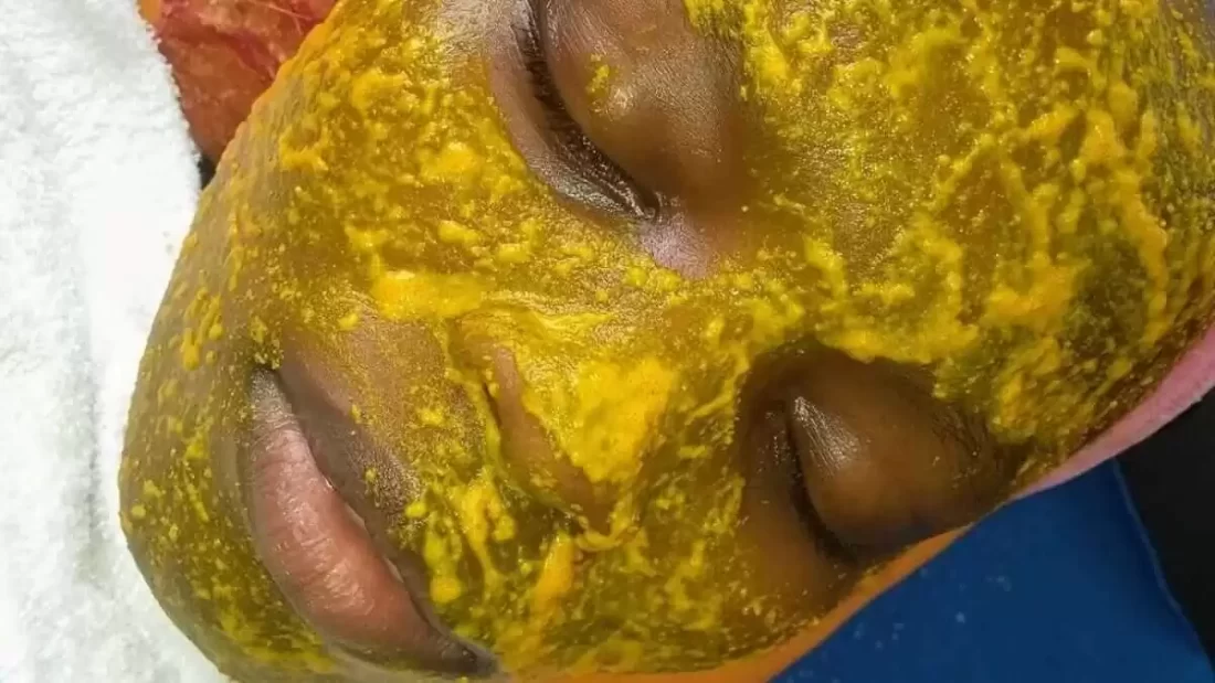 Lemon, Turmeric & Baking Soda Home-made Facial Mask