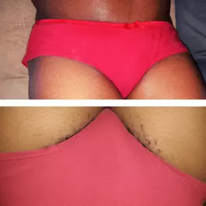 Collage of female client groin with hair popping out of the underwear and a hairless pantyline after waxing hair removal in her home in Nairobi