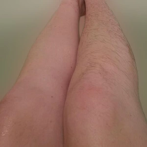 Leg of a caucasian client with and without hair after waxing hair removal service at the client's home in Nairobi